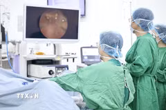 Nhân viên y tế Bệnh viện Đa khoa Gia Đình Đà Nẵng thực hiện điều trị phì đại tuyến tiền liệt lành tính bằng công nghệ hơi nước Rezum cho bệnh nhân mắc Parkinson. (Ảnh: TTXVN phát)