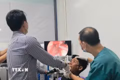 Do tính chất cấp thiết của ca bệnh, bác sỹ thực hiện ca nội soi can thiệp hóc dị vật trong lúc chưa kịp thay áo blouse. (Ảnh: TTXVN phát)