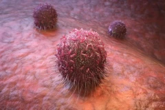 Tế bào ung thư. (Nguồn: scitechdaily)