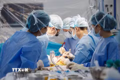 Các bác sỹ Bệnh viện Quân y 175 thực hiện ghép gan cấp cứu cứu sống bệnh nhân suy gan cấp hôn mê 4 ngày. (Ảnh: TTXVN phát)