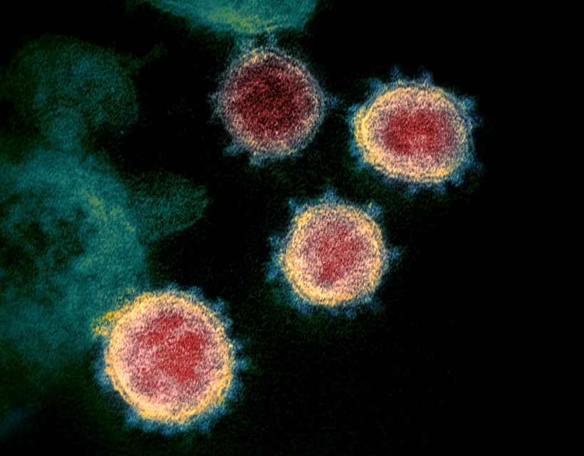 Virus SARS-CoV-2 gây bệnh COVID-19 soi trên kính hiển vi. (Ảnh: AFP/ TTXVN)