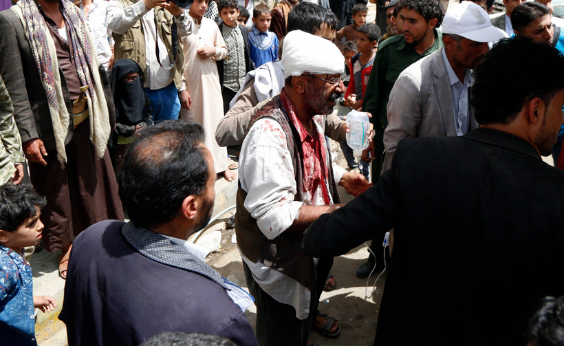 Nạn nhân bị thương tại hiện trường một vụ không kích ở Sanaa, Yemen, ngày 7/4/2019. (Ảnh: THX/TTXVN) 