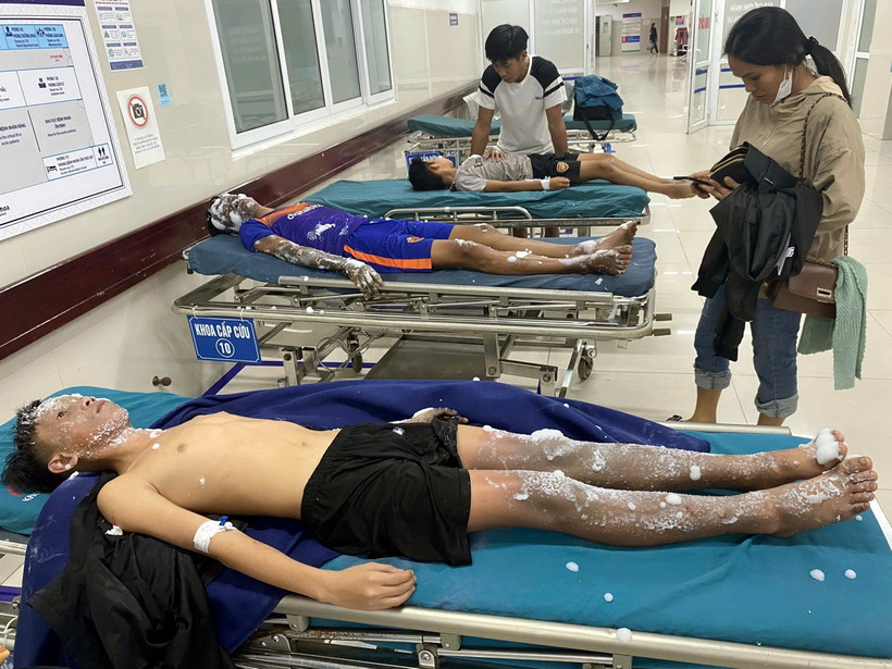 Bốn học sinh nhập viện cấp cứu do chế pháo nổ ở Quảng Bình. (Ảnh: TTXVN phát)