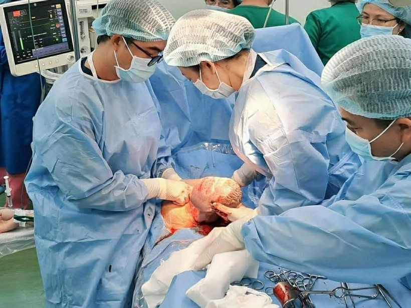 Các bác sỹ Bệnh viện Hùng Vương và Bệnh viện Nhi đồng Thành phố phối hợp phẫu thuật lấy thai an toàn cho bệnh nhi. (Ảnh: TTXVN)