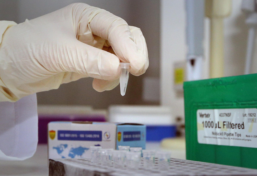 Test xác định virus SARS-CoV-2. (Ảnh: Dương Giang/TTXVN)