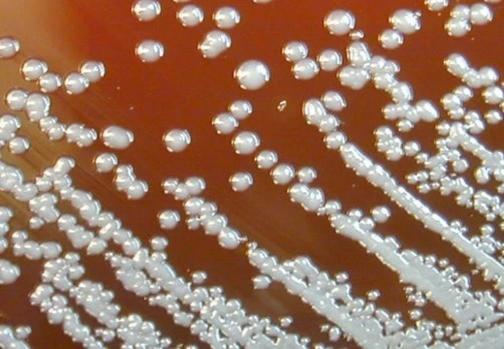 Vi khuẩn Burkholderia pseudomallei gây bệnh Whitmore. (Nguồn: CNN)