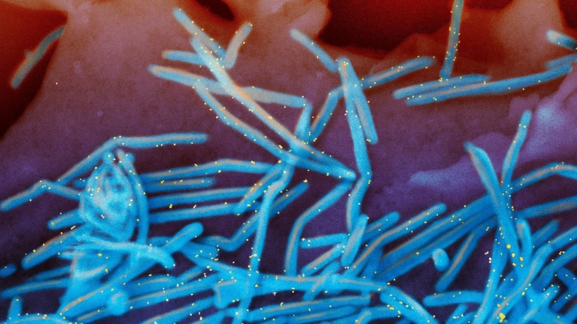 Virus hợp bào hô hấp RSV (màu xanh) và kháng thể RSV (màu vàng). (Ảnh: AP/TTXVN)