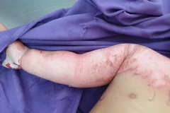 Ảnh minh họa. (Nguồn: AP)