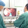 Các bác sỹ tiến hành nội soi cho bệnh nhân. (Nguồn: Bệnh viện Bệnh Nhiệt đới Trung ương)