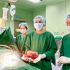 Các bác sỹ phẫu thuật lấy trọn khối u gan lớn ra khỏi cơ thể bệnh nhân. (Ảnh: TTXVN phát)