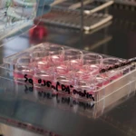 Một thử nghiệm lâm sàng cho thấy việc cấy ghép các cụm tế bào cơ tim được tạo ra từ tế bào iPS vào bệnh nhân suy tim nặng đã giúp cải thiện chức năng tim. (Nguồn: Getty Images)