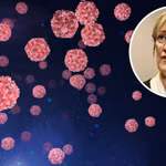 Tiến sỹ Clare Huppatz, Giám đốc Sở Y tế của bang Tây Australia, cho biết nhiều khả năng virus bắt nguồn từ một người đã đi du lịch nước ngoài. (Nguồn: Perthnow)