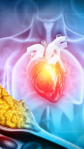 Một trong những bước dễ nhất để cải thiện sức khỏe tim mạch là loại bỏ hoặc hạn chế nghiêm ngặt những thực phẩm gây hại. (Nguồn: iStock)