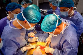 Êkíp thực hiện ca ghép thận cho bệnh nhân tại Bệnh viện Đa khoa tỉnh Quảng Ninh. (Ảnh: TTXVN phát)