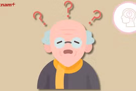Alzheimer - căn bệnh gây suy giảm trí nhớ và sa sút trí tuệ. (Nguồn: Vietnam+)