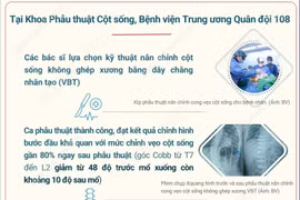 Việt Nam lần đầu phẫu thuật thành công nắn chỉnh vẹo cột sống không ghép xương