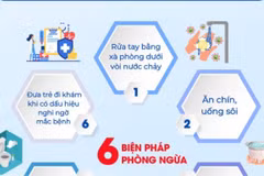 Các biện pháp phòng chống bệnh tay chân miệng