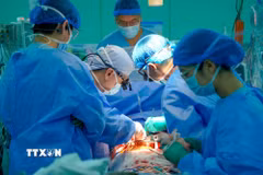Các bác sỹ Bệnh viện Đại học Y dược Thành phố Hồ Chí Minh thực hiện ghép tim cho người bệnh. (Ảnh: TTXVN phát)
