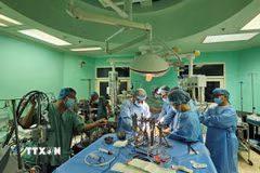 Toàn cảnh một ca phẫu thuật ghép tim tại Bệnh viện Trung ương Huế. (Ảnh: Mai Trang/TTXVN)