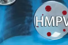 Các chuyên gia Australia khuyến cáo không nên hoảng loạn về virus HMPV.
