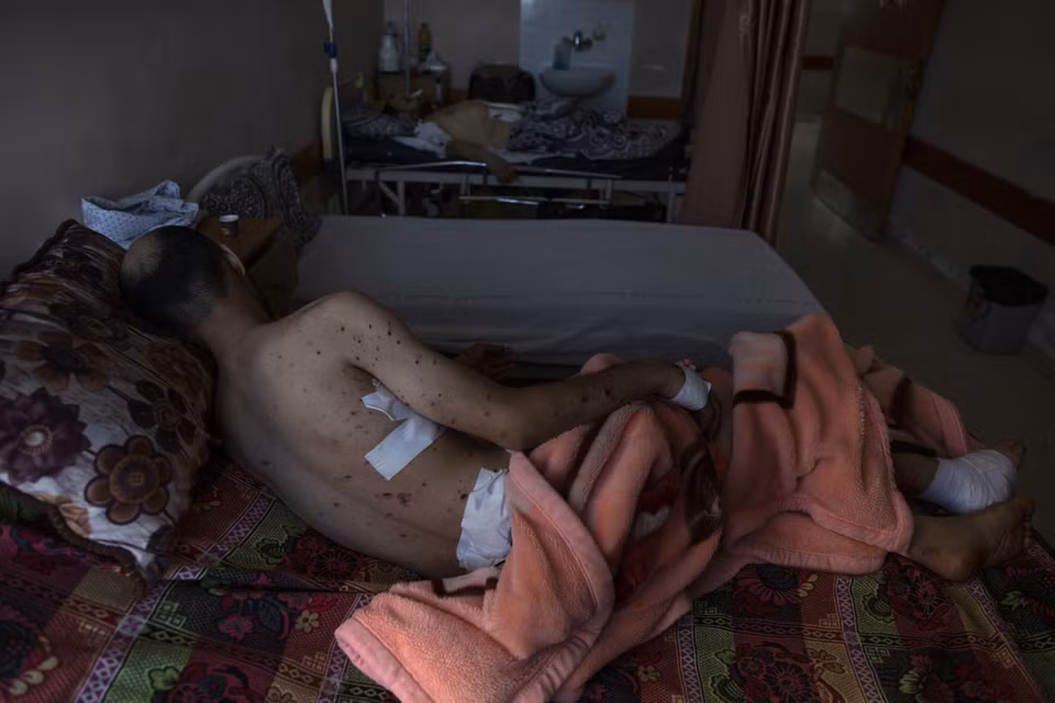 Sharif al-Zaharna, 33 tuổi, nằm ở bệnh viện Shifa ở thành phố Gaza, nơi anh đang được điều trị vết thương do cuộc tấn công ngày 10/5 của Israel vào một ngôi nhà gần đó ở thị trấn Jabaliya. (Ảnh: AP)