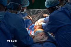 Bác sỹ Bệnh viện Phổi Trung ương đang tiến hành phẫu thuật cho bệnh nhân. (Ảnh: TTXVN phát)