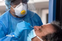 (Tư liệu) Nhân viên y tế kiểm tra thân nhiệt người dân nhằm ngăn chặn sự lây lan của dịch COVID-19 tại Cuango, Panama ngày 18/3/2020. (Ảnh: AFP/TTXVN)