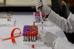 Công tác nghiên cứu về bệnh HIV/AIDS đang có nhiều tiến triển. (Nguồn: Getty)