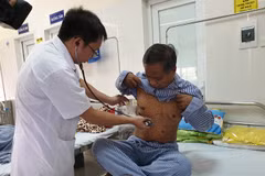 Bác sỹ khám, điều trị cho bệnh nhân mắc bệnh lao tại Bệnh viện Phổi Trung ương. (Ảnh: T.G/Vietnam+)