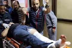 Phóng viên Rashed Rashid của hãng AP trúng đạn. (Nguồn: AP)