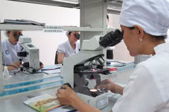 Xét nghiệm lao. (Nguồn: TTXVN)