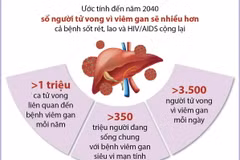 Ngày Thế giới phòng chống viêm gan: Thận trọng với bệnh viêm gan virus 