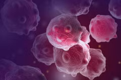 Sanofi ngừng phát triển chất amcenestrant điều trị ung thư vú