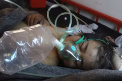 Nạn nhân một vụ tấn công hóa học tại Syria. (Ảnh: AFP)