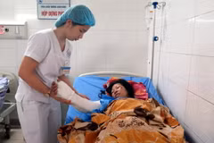 Nạn nhân Lý Thị Thu điều trị tại Bệnh viện Đa khoa Trung ương Thái Nguyên. (Ảnh: Quân Trang/TTXVN)