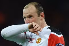 Rooney khổ sở với căn bệnh hói đầu. (Nguồn: Getty)