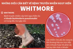 [Infographics] Những điều cần biết về căn bệnh nguy hiểm Whitmore