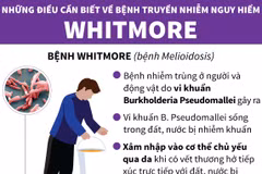 [Infographics] Những điều cần biết về căn bệnh nguy hiểm Whitmore