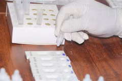Xét nghiệm test nhanh SARS-CoV-2. (Ảnh: Bích Huệ/TTXVN)