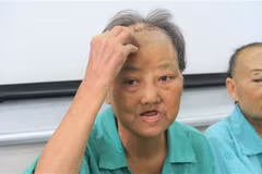 Bệnh nhân Phan Thị H. (Tây Ninh) kể lại tình trạng bệnh khi nhập viện. (Ảnh: Đinh Hằng/TTXVN)
