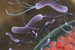 Vi khuẩn Helicobacter Pylori đóng vai trò quan trọng trong việc ngăn ngừa bệnh suyễn cuống phổi. (Nguồn: Internet)