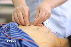 Các bệnh nhân được sử dụng phương pháp Điện châm tại Bệnh viện Y học cổ truyền tỉnh Lạng Sơn. (Ảnh: Anh Tuấn/TTXVN)