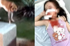 TP Hồ Chí Minh: Bé gái 4 tuổi bị chó tấn công, thương tích nghiêm trọng vùng mặt