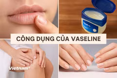 Vaseline thực sự là một sản phẩm đa dụng. (Ảnh: Vietnam+)