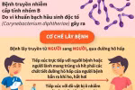Những điều cần biết về bệnh bạch hầu và cách phòng tránh