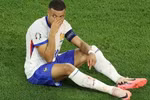 Mbappe không phải phẫu thuật nhưng sẽ đeo mặt nạ khi ra sân thi đấu. (Nguồn: EPA)