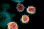 Virus SARS-CoV-2 gây bệnh COVID-19 soi trên kính hiển vi. (Ảnh: AFP/ TTXVN)
