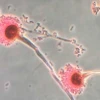 Nấm Aspergillus. (Nguồn: CNN)