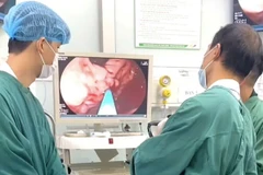 Các bác sỹ tiến hành nội soi cho bệnh nhân. (Nguồn: Bệnh viện Bệnh Nhiệt đới Trung ương)