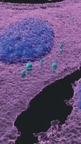 Ảnh huỳnh quang miễn dịch 3D cho thấy các tế bào u hắc tố (màu tím hồng) bị nhiễm vi khuẩn (màu xanh ngọc); nhân tế bào có màu xanh lam. (Nguồn: Viện Khoa học Weizmann)
